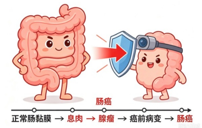 【防癌早筛 百问百答】第三期 一根肠镜保平安—— 从息肉到肠癌，中间有10年窗口期